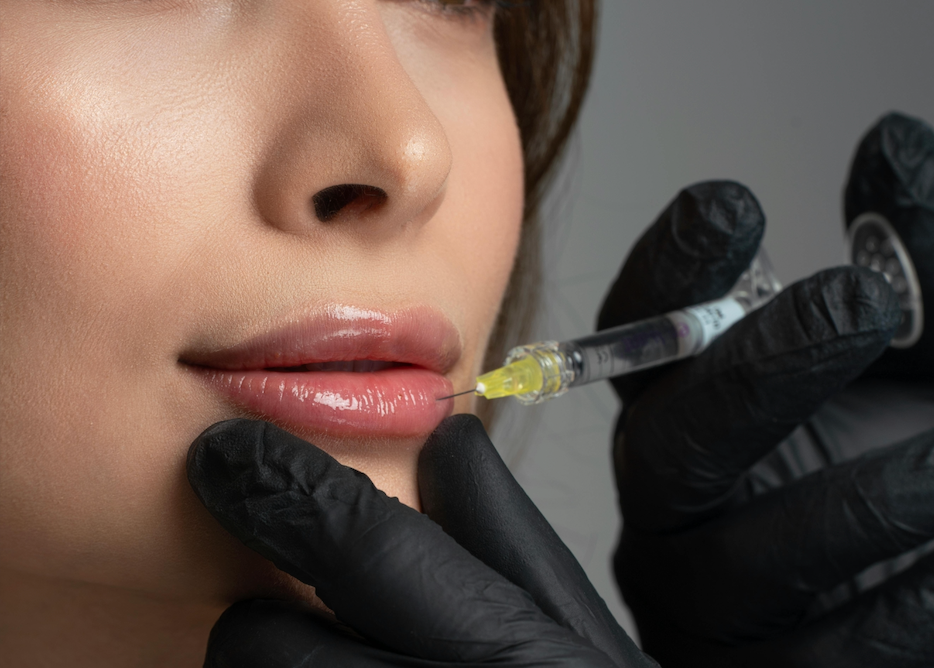 Injection d’agent de comblement pour rides et volume du visage