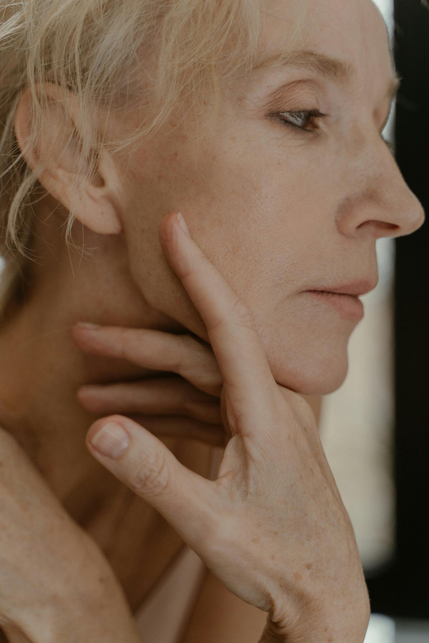 Microdermabrasion