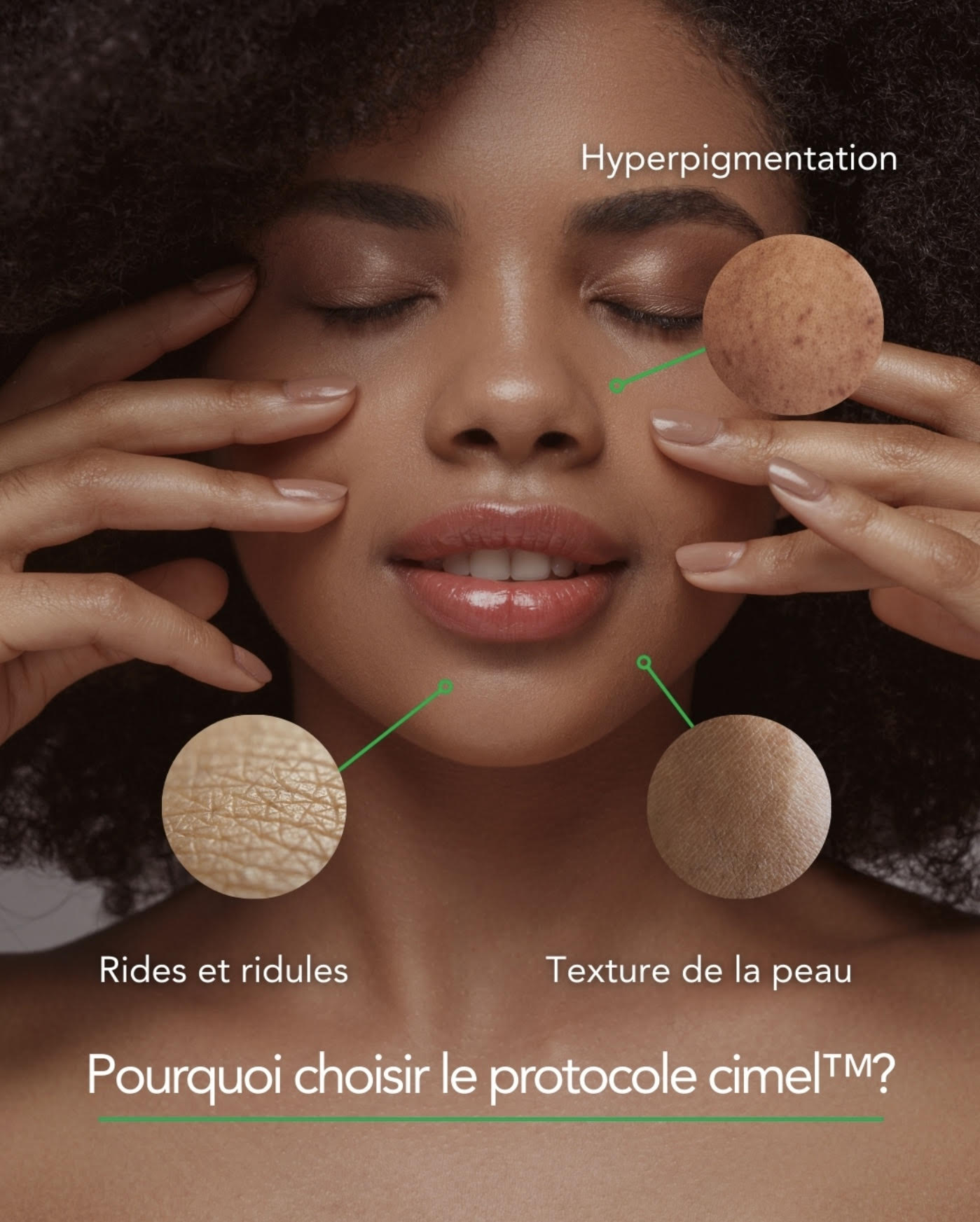 Les secrets des peelings Cimel révélés