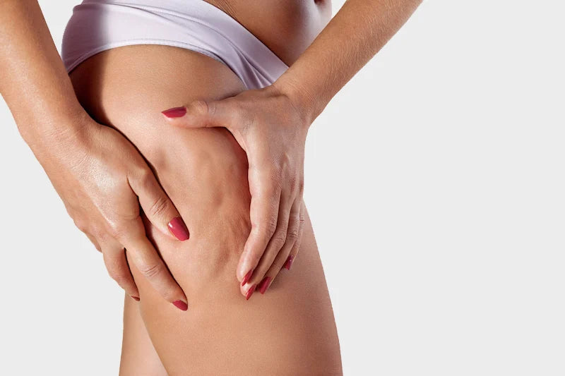 Cellulite sur les cuisses