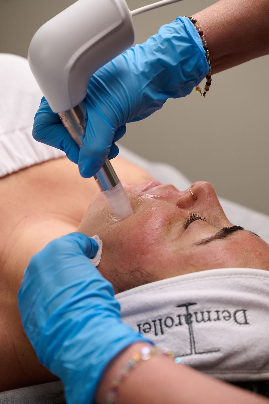 Microneedling